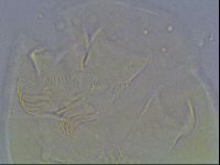 Echiniscus bigranulatus image
