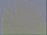 Echiniscus bigranulatus image