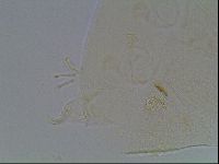 Echiniscus bigranulatus image