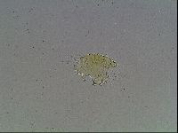 Echiniscus bigranulatus image