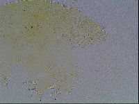 Echiniscus bigranulatus image