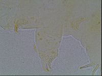 Echiniscus bigranulatus image
