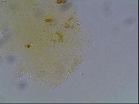 Echiniscus bigranulatus image
