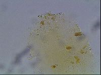Echiniscus bigranulatus image