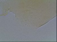 Echiniscus bigranulatus image