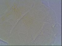 Echiniscus bigranulatus image