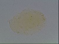 Echiniscus bigranulatus image