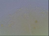 Echiniscus bigranulatus image