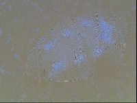Echiniscus bigranulatus image