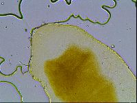 Echiniscus bisetosus image