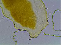 Echiniscus bisetosus image
