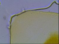 Echiniscus bisetosus image