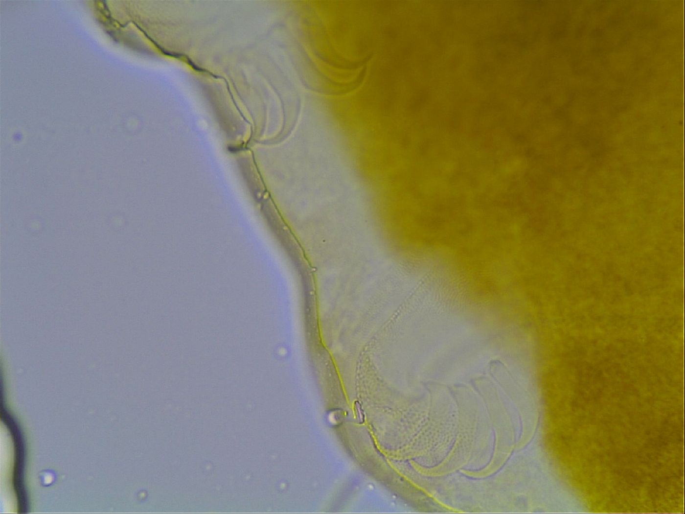 Echiniscus bisetosus image