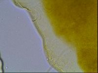 Echiniscus bisetosus image
