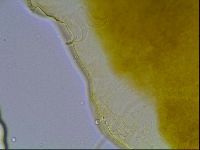 Echiniscus bisetosus image