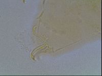 Echiniscus blumi image
