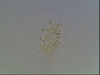 Echiniscus blumi image