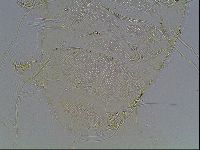 Echiniscus blumi image