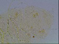 Echiniscus blumi image
