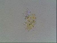 Echiniscus blumi image
