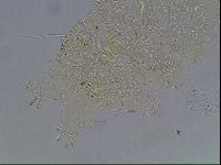 Echiniscus blumi image