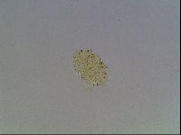 Echiniscus blumi image