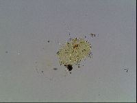 Echiniscus blumi image