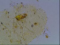 Echiniscus blumi image