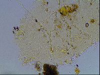 Echiniscus blumi image