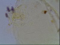 Echiniscus blumi image