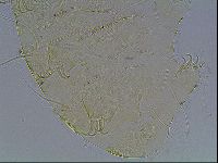 Echiniscus blumi image
