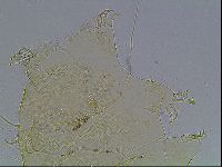 Echiniscus blumi image