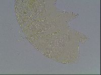 Echiniscus blumi image