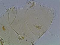 Echiniscus blumi image
