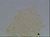 Echiniscus blumi image