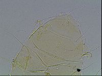 Echiniscus blumi image