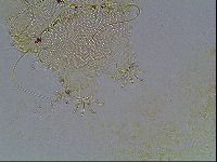 Echiniscus blumi image
