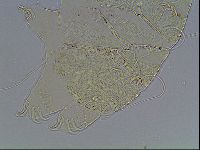 Echiniscus blumi image