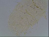 Echiniscus blumi image