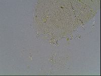 Echiniscus blumi image