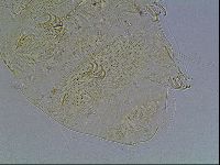 Echiniscus blumi image