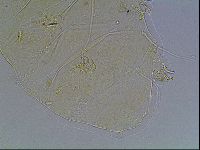 Echiniscus blumi image
