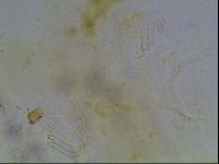 Echiniscus blumi image