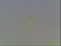 Echiniscus blumi image
