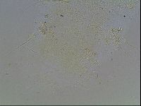 Echiniscus blumi image