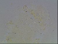 Echiniscus blumi image