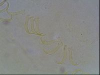 Echiniscus blumi image
