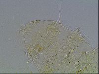 Echiniscus blumi image