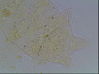 Echiniscus blumi image