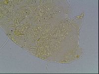 Echiniscus blumi image